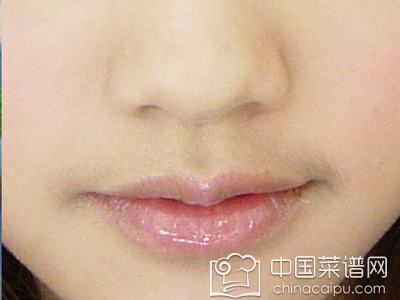 ���粻ͨ��֢״ һ�������Ϊ����ҽ