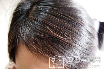 少年白发如何治疗 食疗帮你解决烦恼